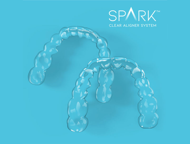 Spark-Clear-Aligner System