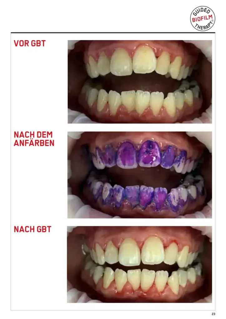 testgbt scaled 2